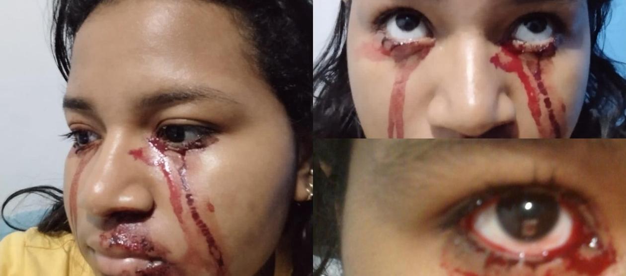 El sangrado que registra Zharick. Su familia autorizó la publicación de las fotos.