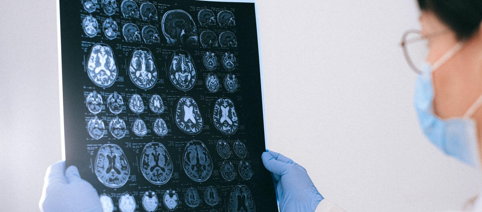 Imagen de referencia.