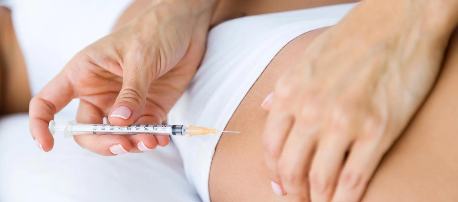 Imagen de referencia.