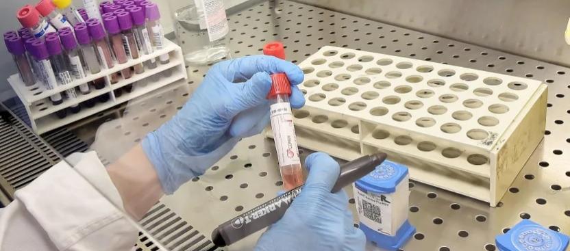 La XBB.1.5 es la variante de la covid-19 dominante en Ecuador