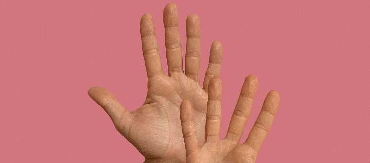 Imagen de referencia.