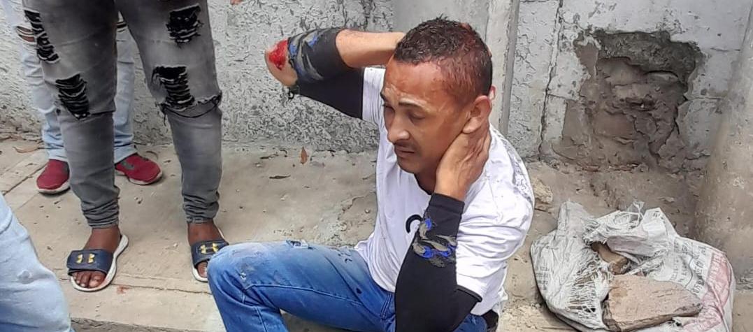 Uno de los presuntos ladrones después de ser golpeado por la comunidad.