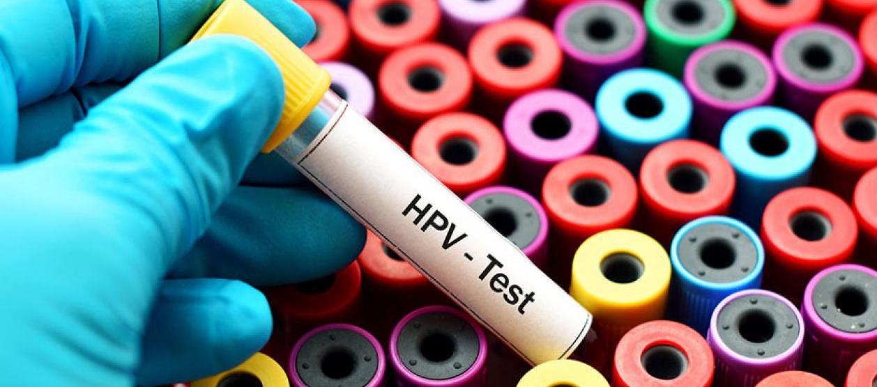 Imagen de referencia.