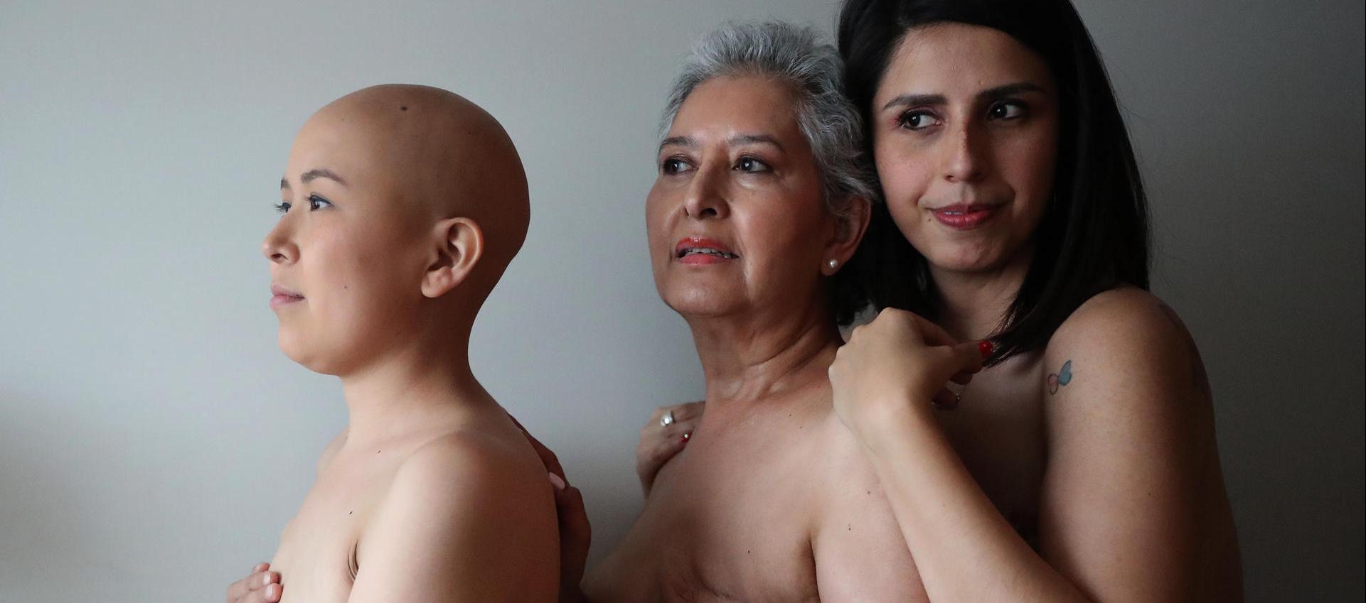 Lorena Estrada, Angeles Arreola y Sandra Monrroy, pacientes con cáncer de mama.