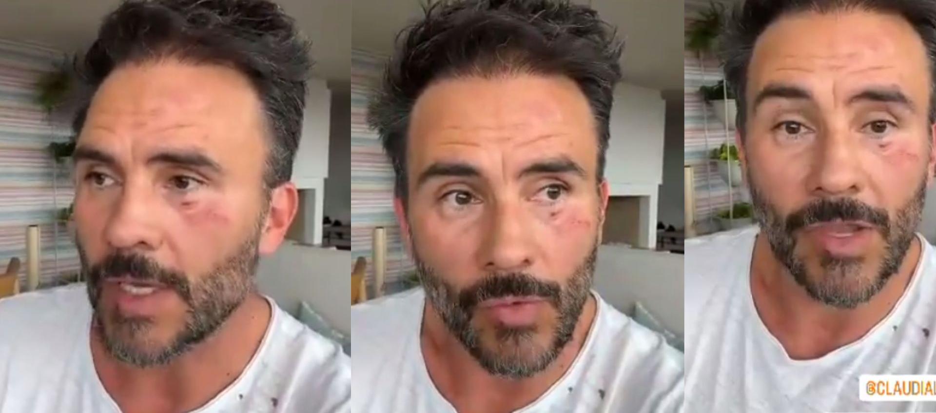 El actor Juan Pablo Raba narrando el hecho.