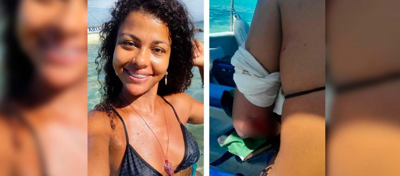 La ingeniera industrial Wendy Pacheco, herida por un yate