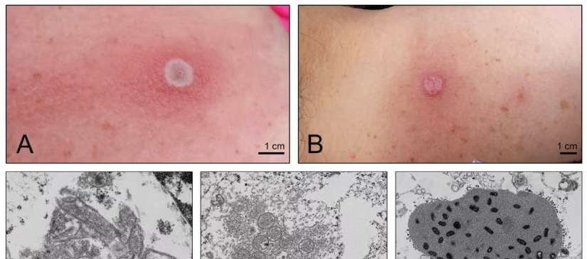 Imágenes referenciales del virus Alaska.