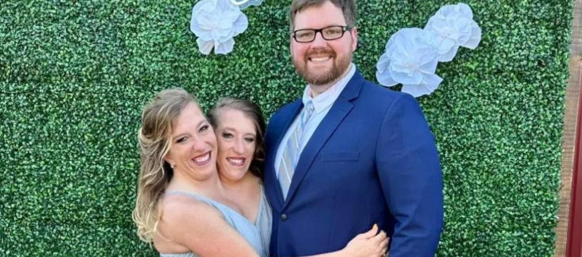 Las gemelas siamesas afirmaron que en algún momento de su vida anhelaban ser madres.