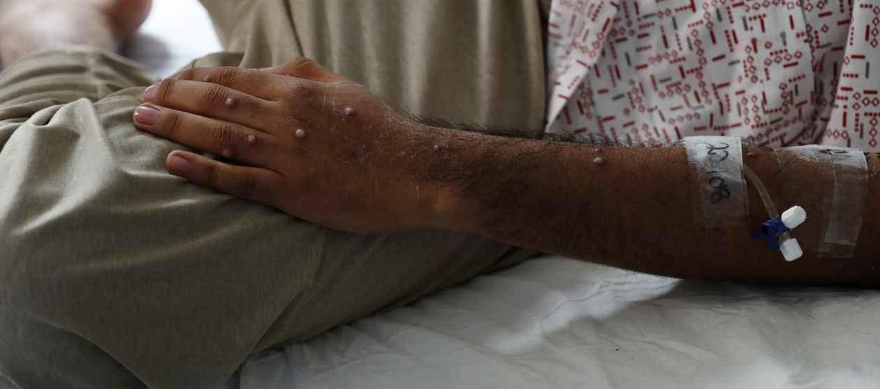 Imagen de referencia.