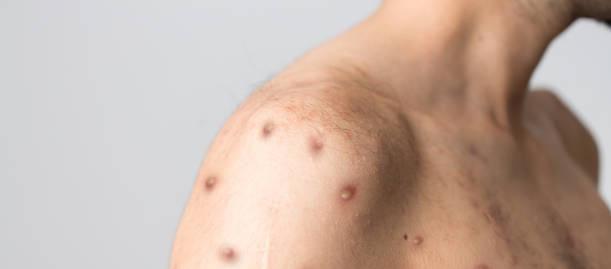 Imagen de referencia.