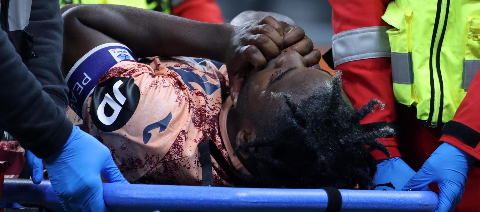 Duván Zapata abandonó la cancha con lágrimas y en camilla.