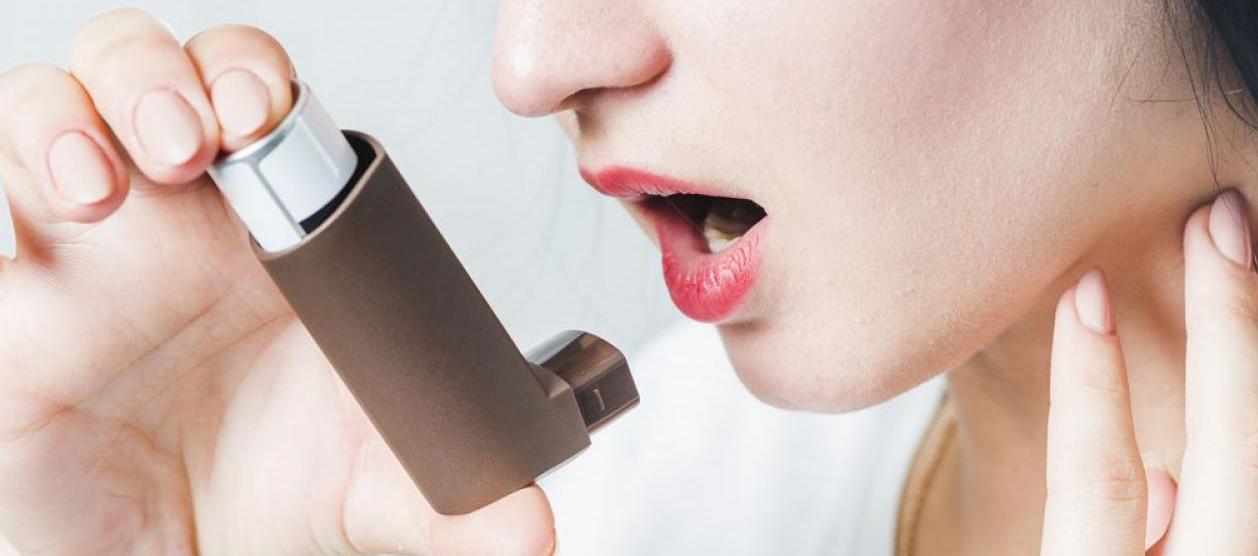 La Asociación hizo un llamado al Gobierno a implementar acciones inmediatas. 