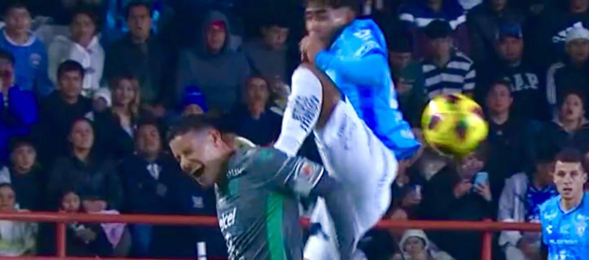 La patada que sufrió James Rodríguez.