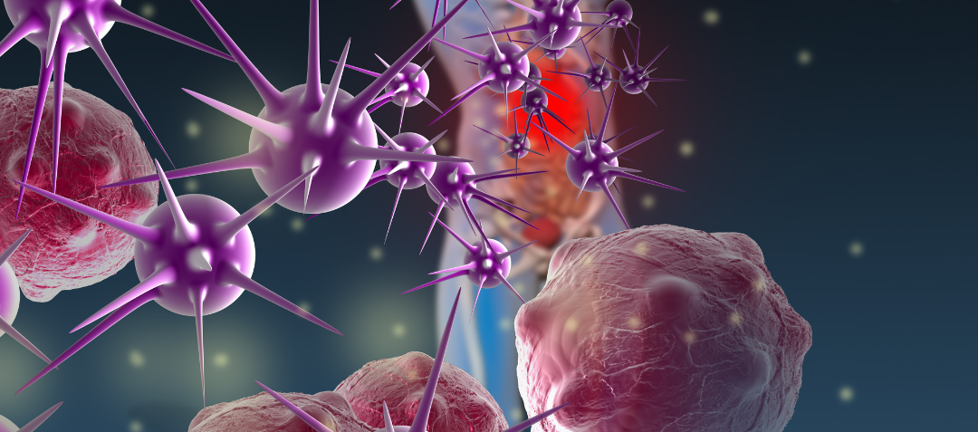 Ilustración de enfermedades raras