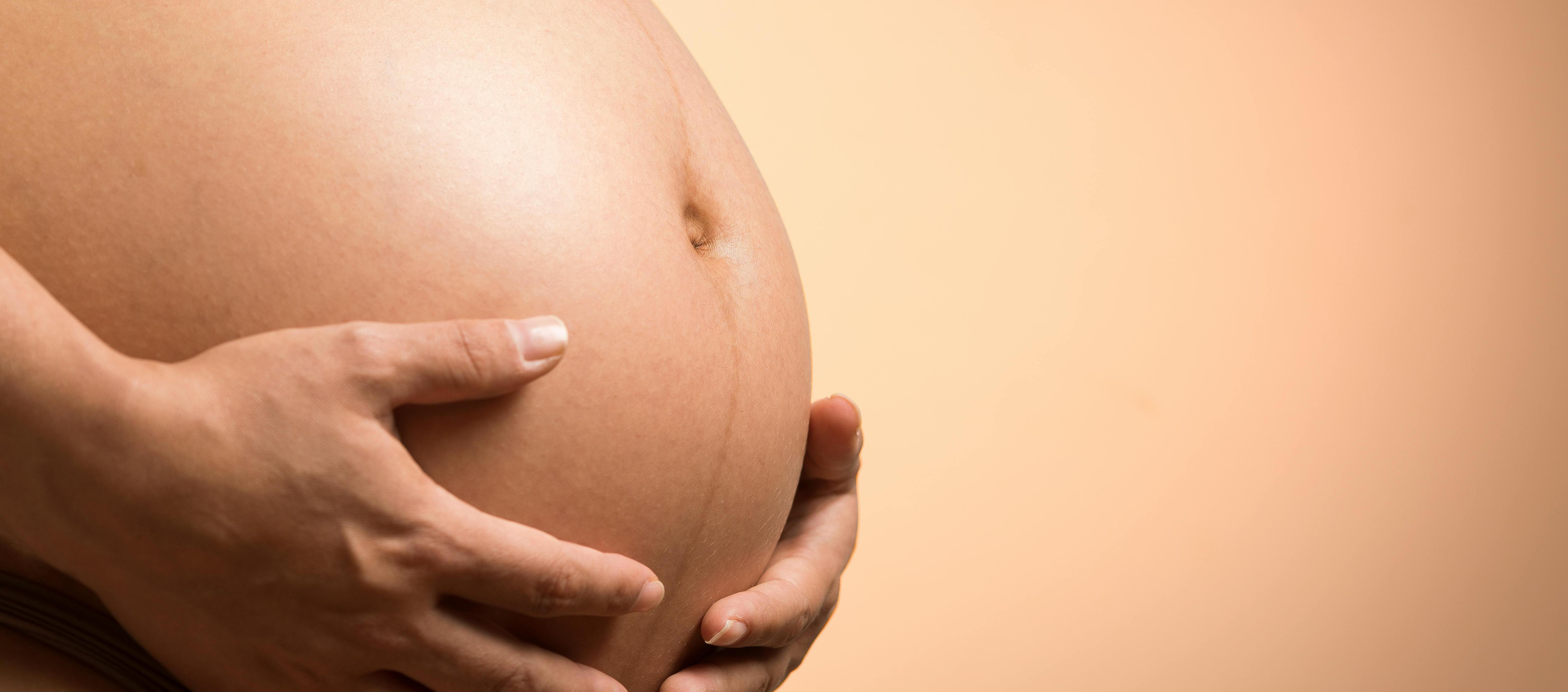 Imagen de referencia.