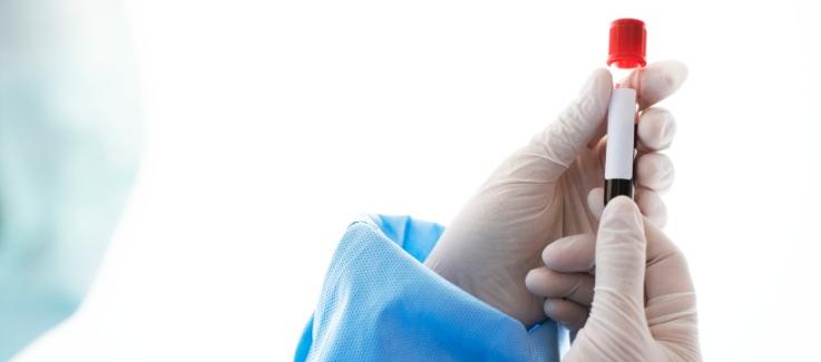 Imagen de referencia.