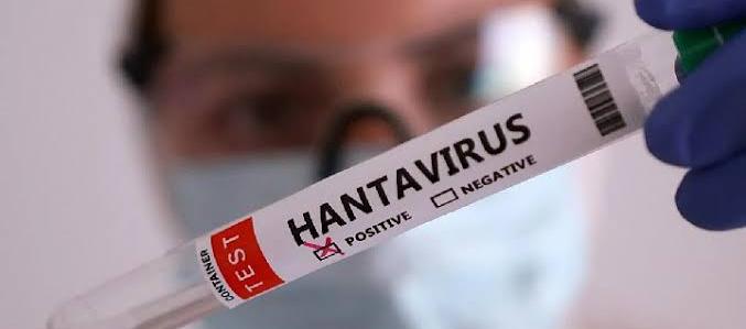 Tres fallecidos por hantavirus en Venezuela