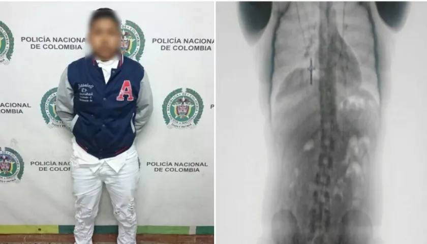 Capturada y radiografía que muestra las cápsulas.