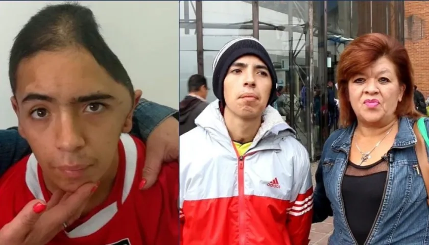 Harry Estiven Rodríguez, de 22 años. Se recupera de las fracturas que sufrió a manos de hinchas rivales.