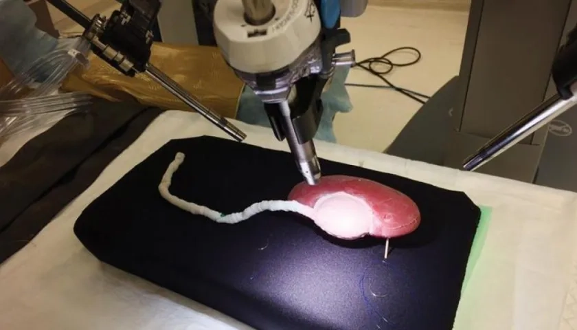 Réplica impresa en tres dimensiones (3D) de un riñón.