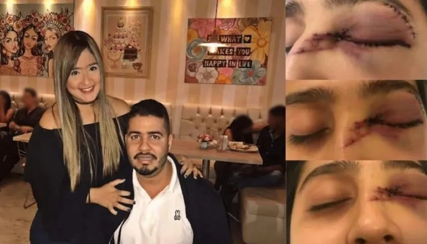 Daniela junto a su esposo e imágenes  de como le quedó el rostro tras la agresión. 