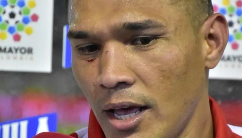 Así quedó el rostro de Teófilo Gutiérrez tras el codazo de Baldomero Perlaza.