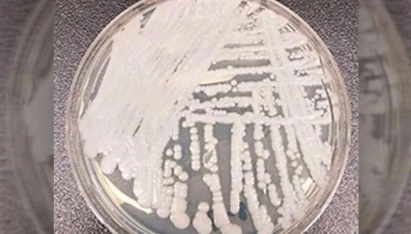 La Cándida auris apareció en 2015 y tiene vigilancia en Colombia desde el año 2016.