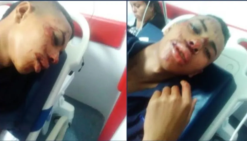 Dayro Andrade Muñoz, hincha de 16 años, agredido por hinchas violentos de Millonarios.