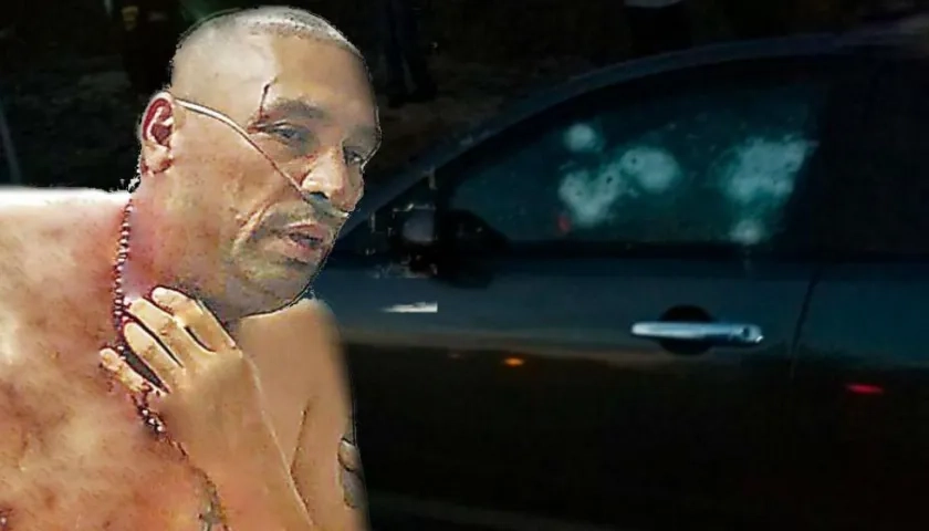 Alias 'Baltazar' tras el atentado.