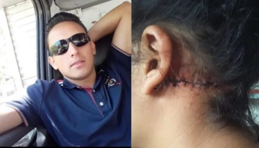  Edward Alexánder Porras Bohórquez agredió brutalmente a su exnovia.