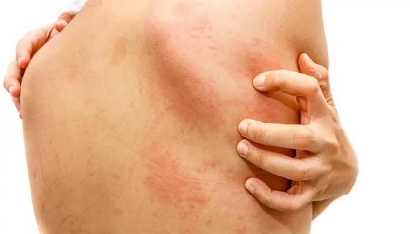 Quienes acudan a la jornada recibirán el diagnóstico y orientación gratis.