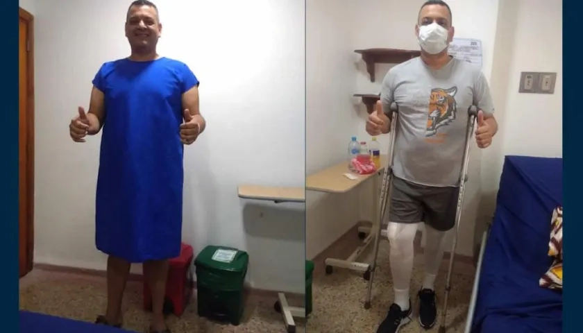 Jairo Colmenares Martínez, luego de ser sometido a la operación.