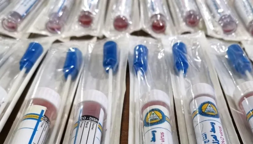 Muestras para Covid-19.