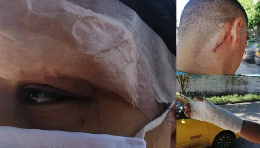 Familiares del soldado muerto resultaron golpeados. 