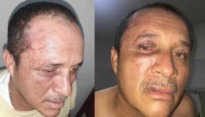 Así quedó el taxista tras la agresión.