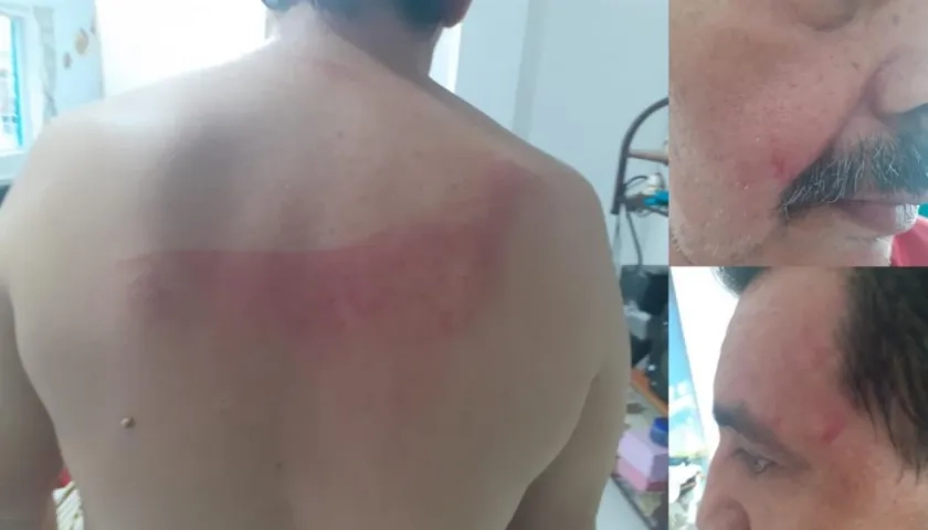 Agresión a uno de los hombres.