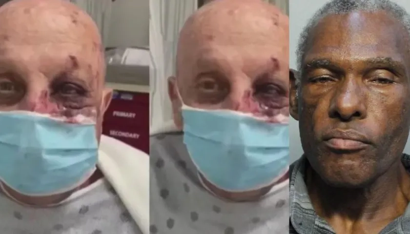 Eduardo Fernández y el agresor Robert Lee Ribbs.