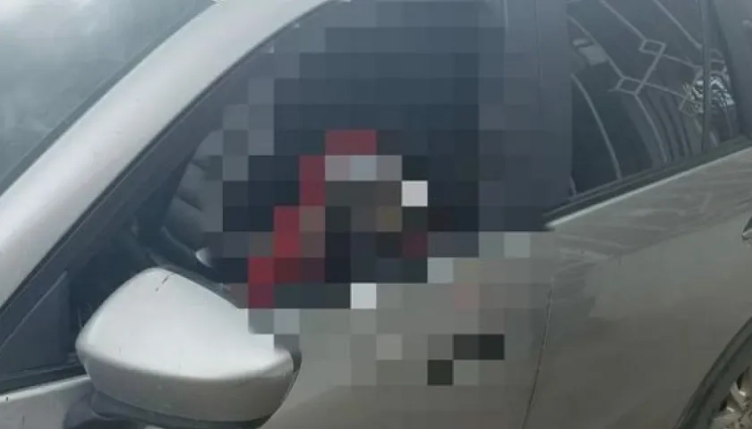 Jhon Fredy Amador Miranda, tras el ataque a bala.