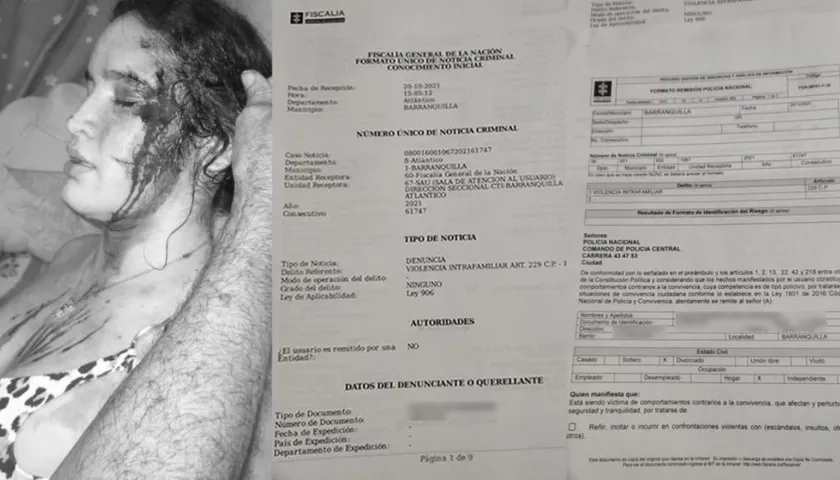 Joven que recibió brutal golpiza de su expareja