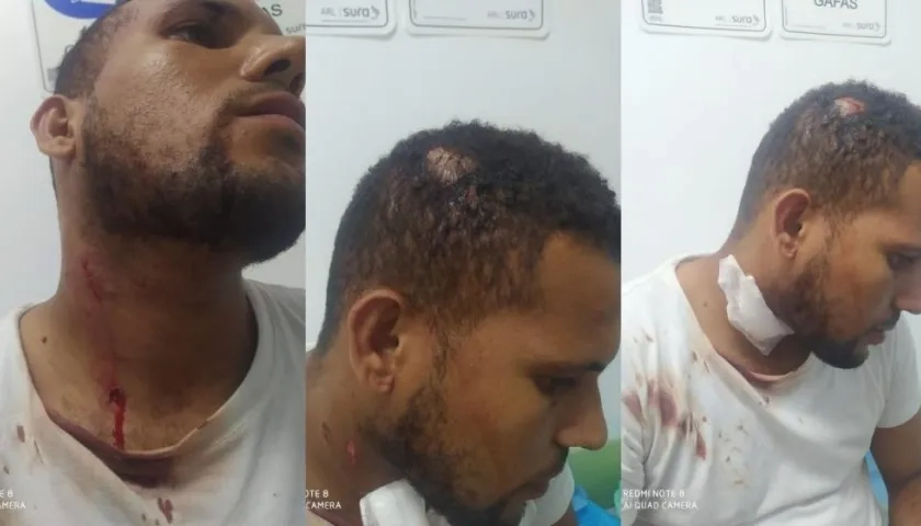 El árbitro Arlinton Ariza mostrando las violentas heridas recibidas.