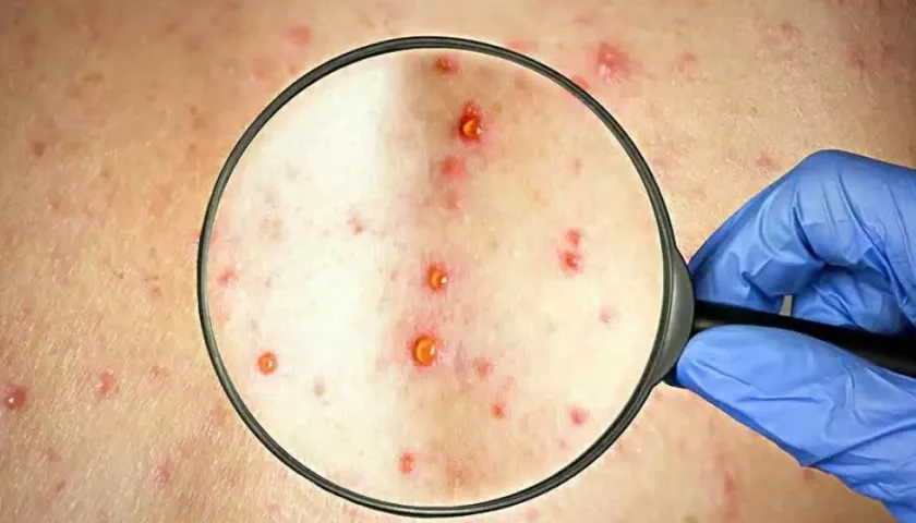 Imagen de referencia.