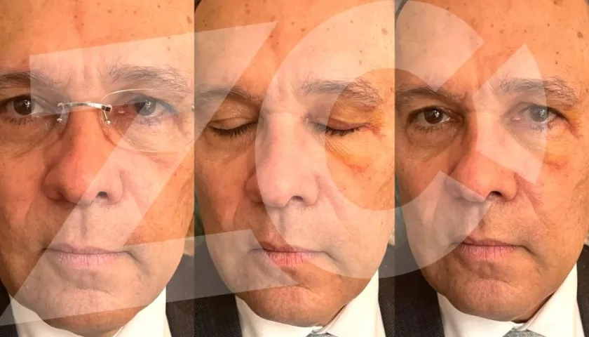 Las lesiones causadas al Senador Efraín Cepeda Sarabia.