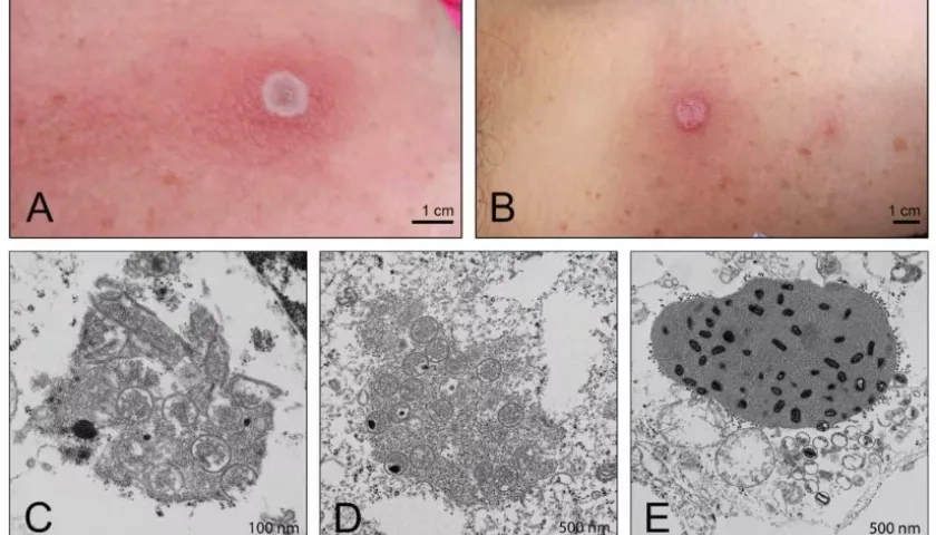 Imágenes referenciales del virus Alaska.