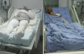 Álvaro Solano, interno que intentó suicidarse, y Francisco Acosta  recluso quemado.