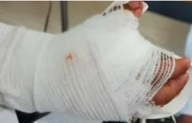 Gobierno hace llamado a disminuir las cifras de lesionados por pólvora.