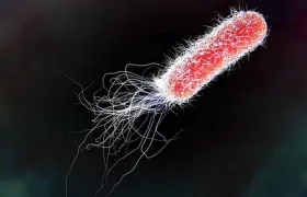  E. Coli es una de las infecciones que según este estudio muestran resistencia. 
