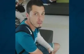 Leonardo Pico se fracturó el brazo izquierdo. 