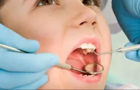 Según una especialista, las caries no solo son un problema bucal, sino de nutrición.