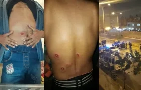 El enfrentamiento ocurrió anoche pasada las 10 p.m.