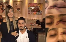 Daniela junto a su esposo e imágenes  de como le quedó el rostro tras la agresión. 